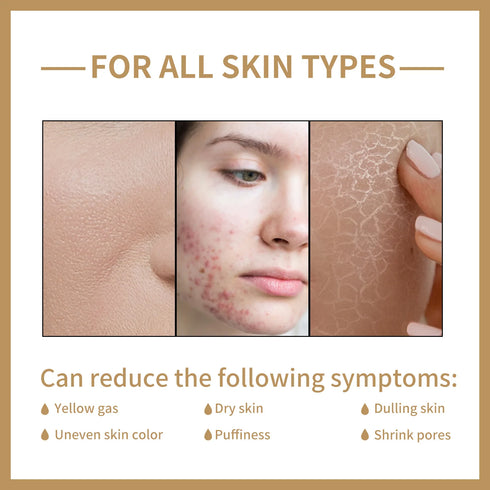 Rice Water Facial Toner – 150ml Moisturizing and Pore-Shrinking Serum for Skin Brightening and Rejuvenation