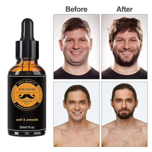 Beard Growth Kit For Men Beard Hair Enhancerbeard Essential Oil Moisturizing Wax Growth Roller Comb Styling Scissors Beard Care