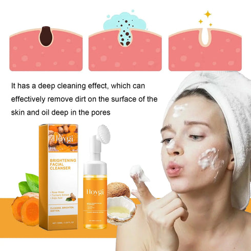 Turmeric Anti-Acne Facial Cleanser – 100ml Plant-Based Foaming Face Wash for Oil Control, Blackhead Removal, Pore Refinement, and Skin Brightening