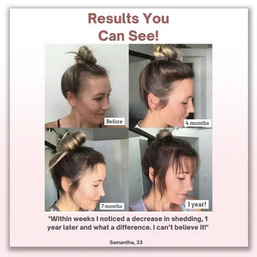 3 Modes Multi-Functional Infrared Electric Massage Comb | Massage, Nourish & Regrow