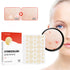 144-Piece Hydrocolloid Acne Pimple Patch Set – Invisible Absorbing Spot Stickers for Facial Blemish Protection and Healing Care for Men and Women