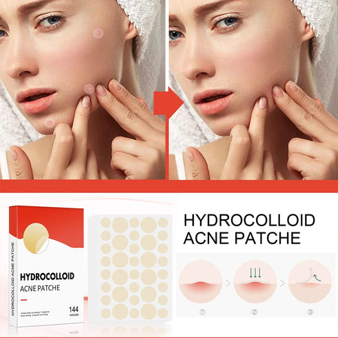 144-Piece Hydrocolloid Acne Pimple Patch Set – Invisible Absorbing Spot Stickers for Facial Blemish Protection and Healing Care for Men and Women