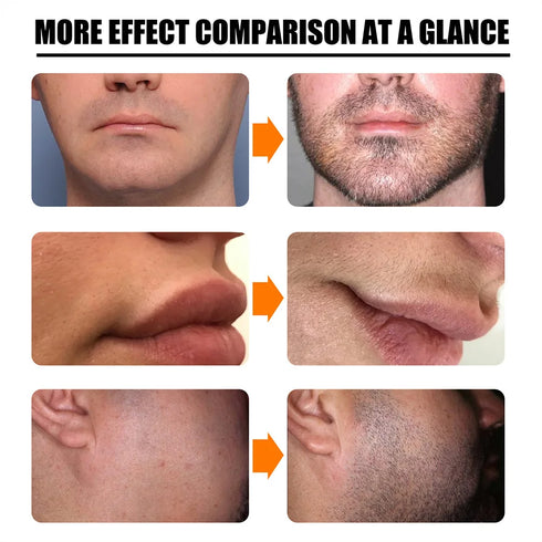 Natural Men Beard Growth Roller Kit Men's Beard Growth Oil Nourishing Enhancer Beard Oil Spray Anti Hair Loss With Beard Roller