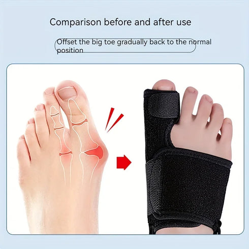 Toe Thumb Valgus Orthopedic Band – Adjustable Spring Support for Foot Alignment & Sport Safety